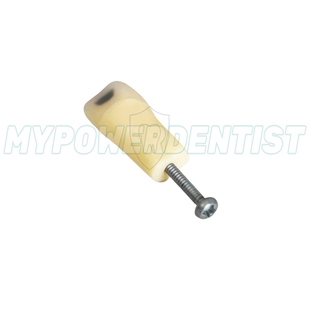 Dental Cavity Teeth Model Tooth Teaching Caries 25# Compatible Frasaco AG-3