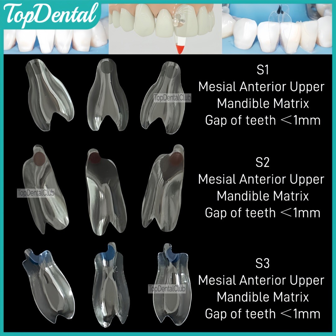 USA Clear Matrix Dental Anterior Posterior Transparent BT Matrices Fits BioClear