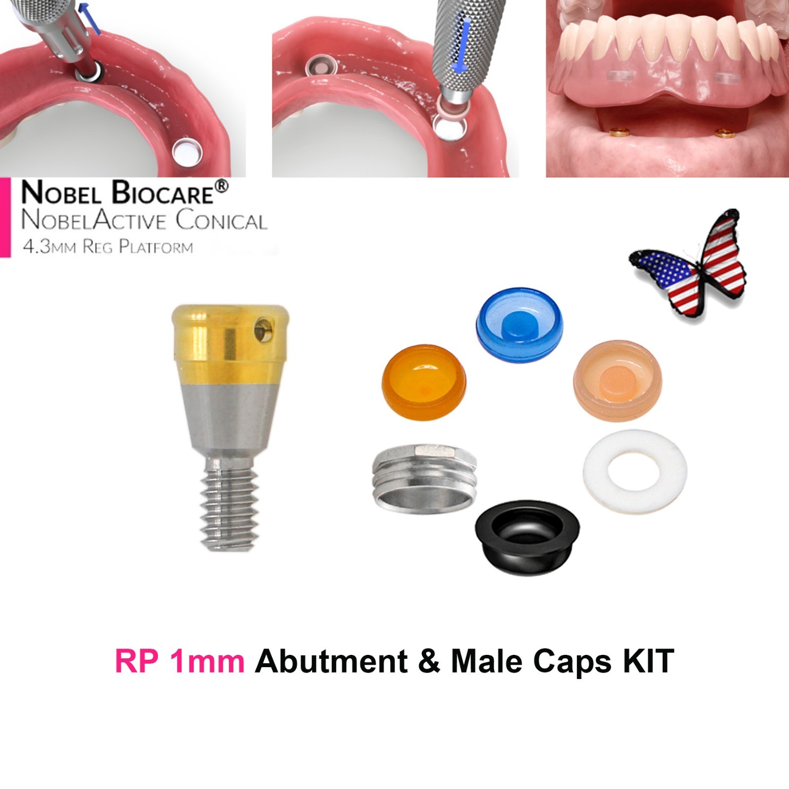 US Dental Locator Abutment Male Caps Kit Fit Hiossen Nobel Zimmer Implant System