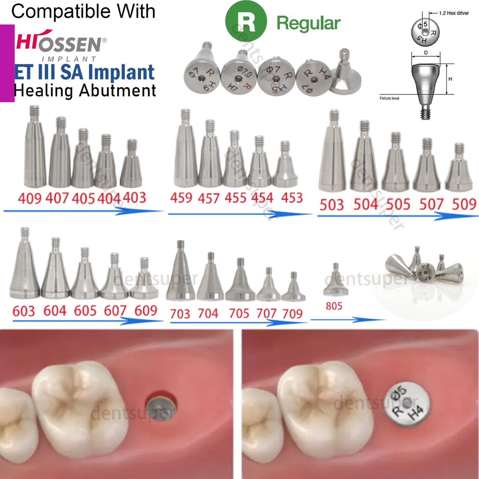 Dental Healing Abutment Cover Screw for ITI, Hiossen, Nobel, NC/RC, Regular/Mini