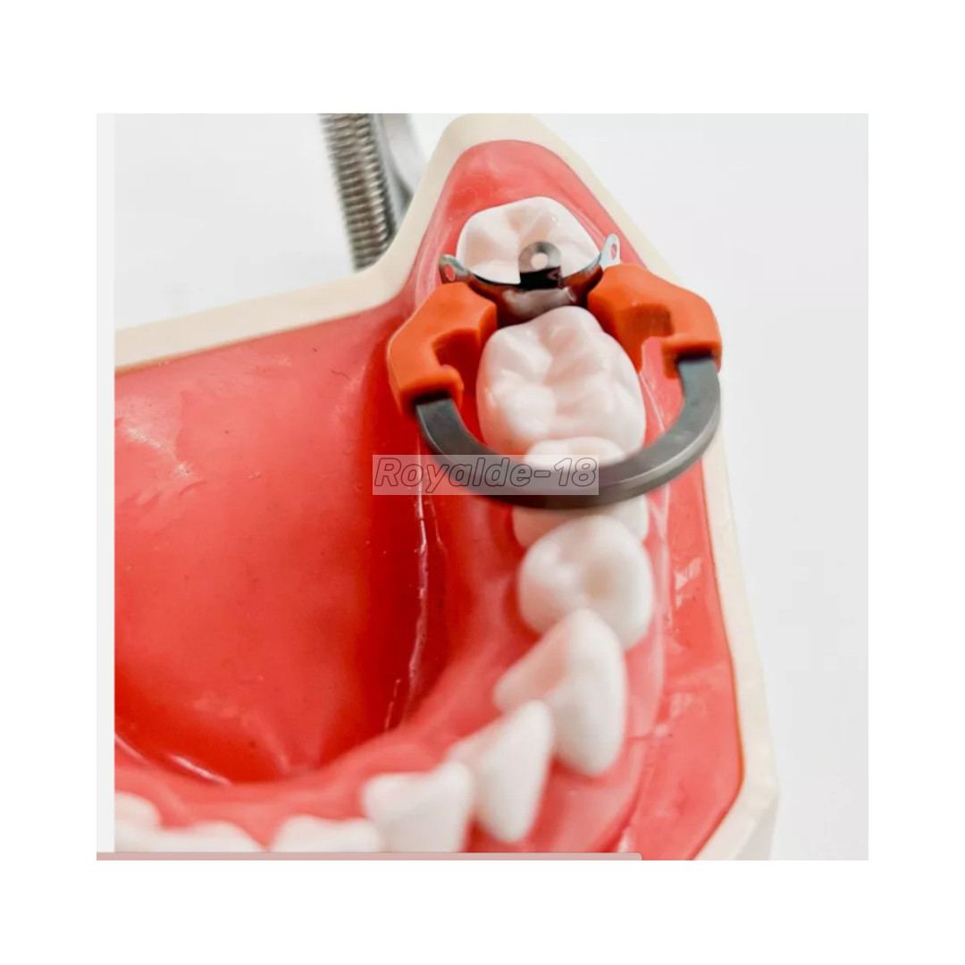 Dental Matrix Band Ring Sectional Matrice Clamp C2 D2/3 Fit Garrison Palodent V3