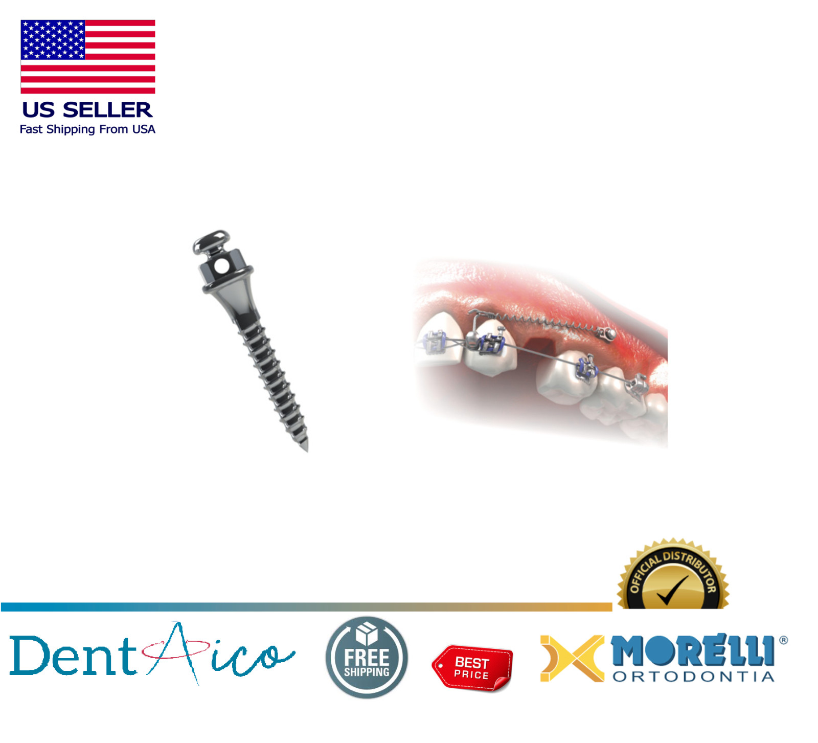 Morelli Orthodontic Mini Screw Leng.: 10mm Transm.: 2mm Ø1.5mm Dental Supply