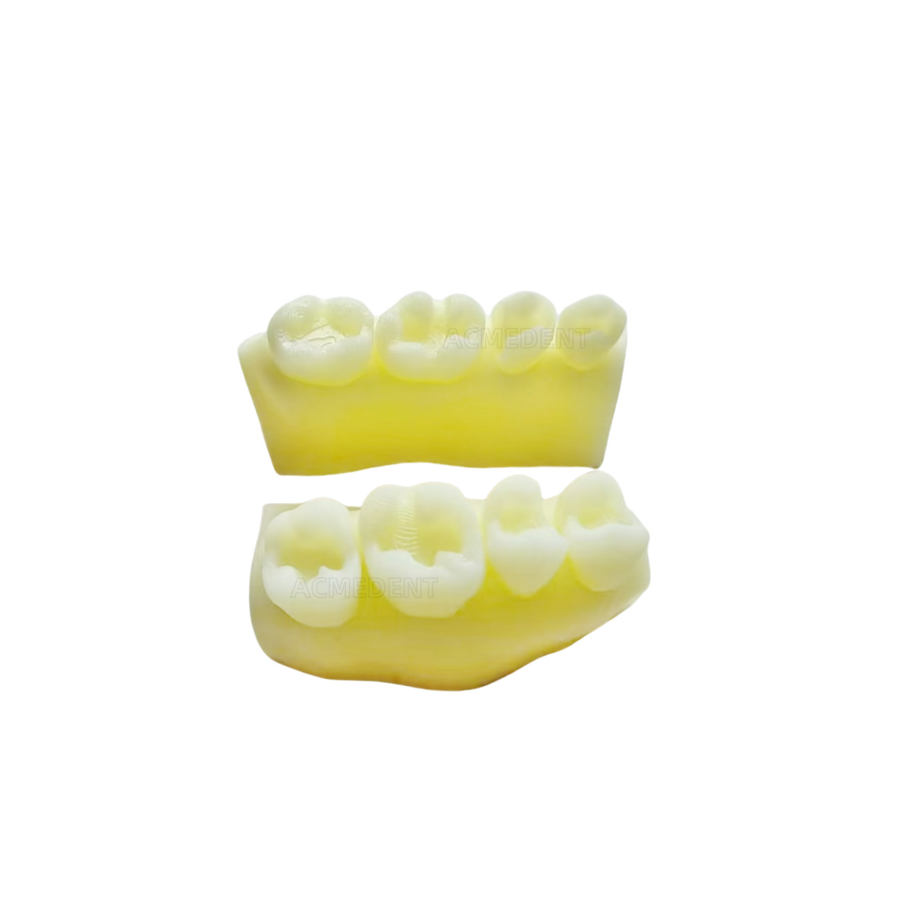 3Pieces Dental Healing Cap Abutment NP 3.6 H3 H5 H7 Compatible Nobel Active ∅3.6