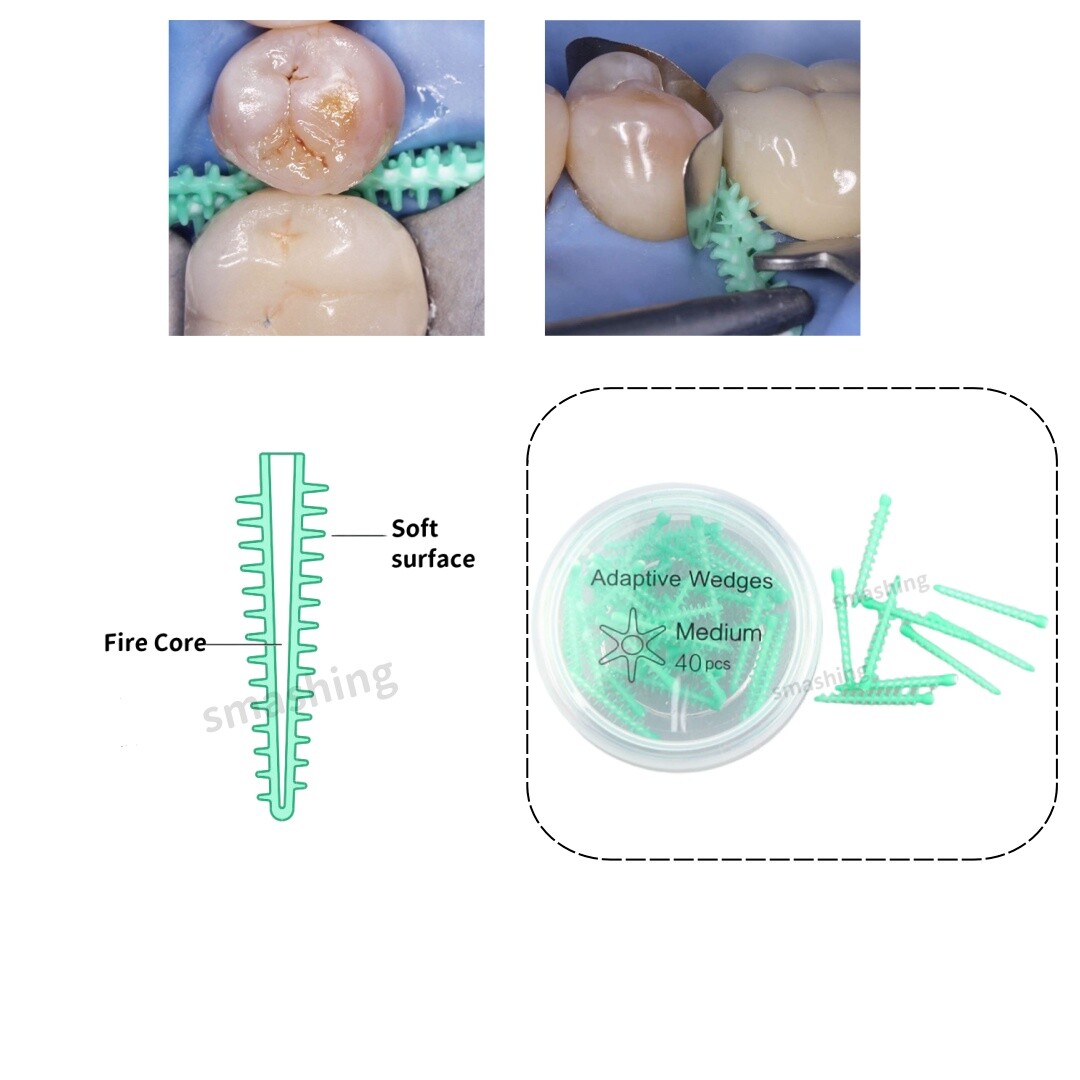 Dental Adaptive Wedges Thorn Soft Face Wedge Firm Core Matrix 134℃