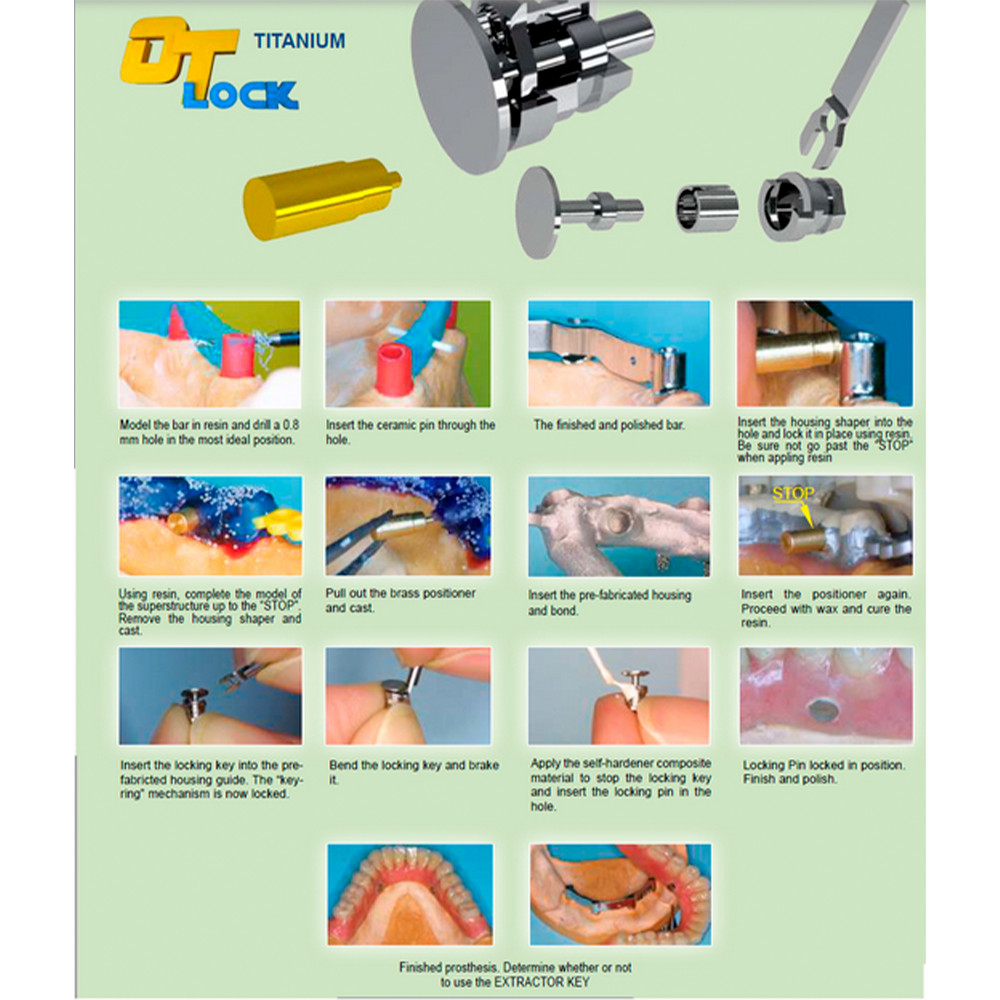 Dental OT Lock Unlocking Key For Titanium Kit Denture Orthodontic System Rhein83