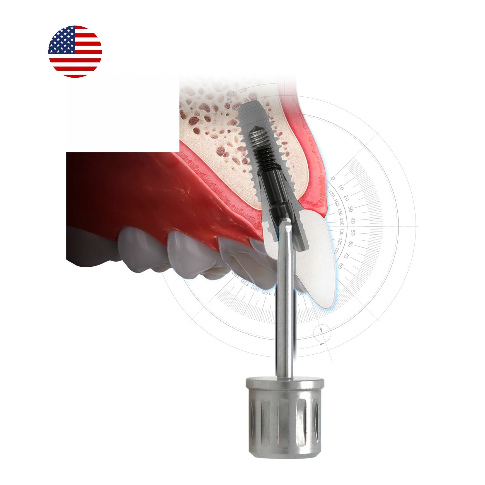 Screwdriver Nobel Biocare Angulated Screw Channel Manual Torque Ratchet ASC T5