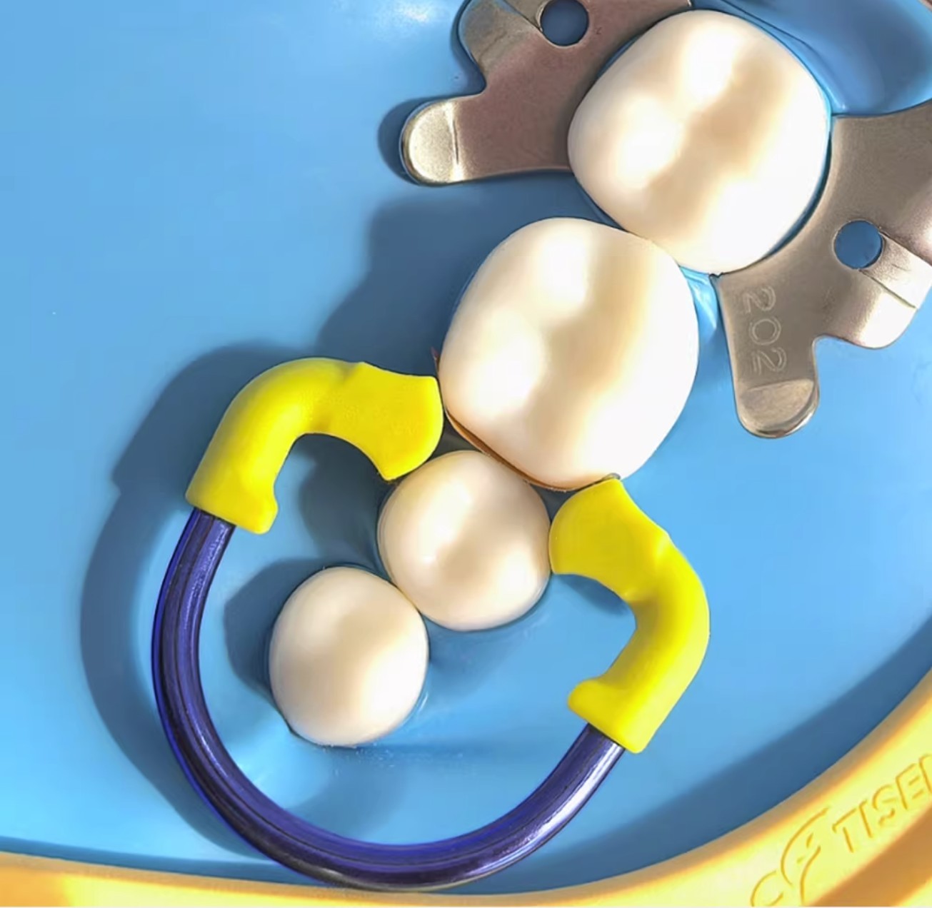 Dental Ni-ti Clamping Ring Adult High Crown Matrix Retainer Dentist Restoration