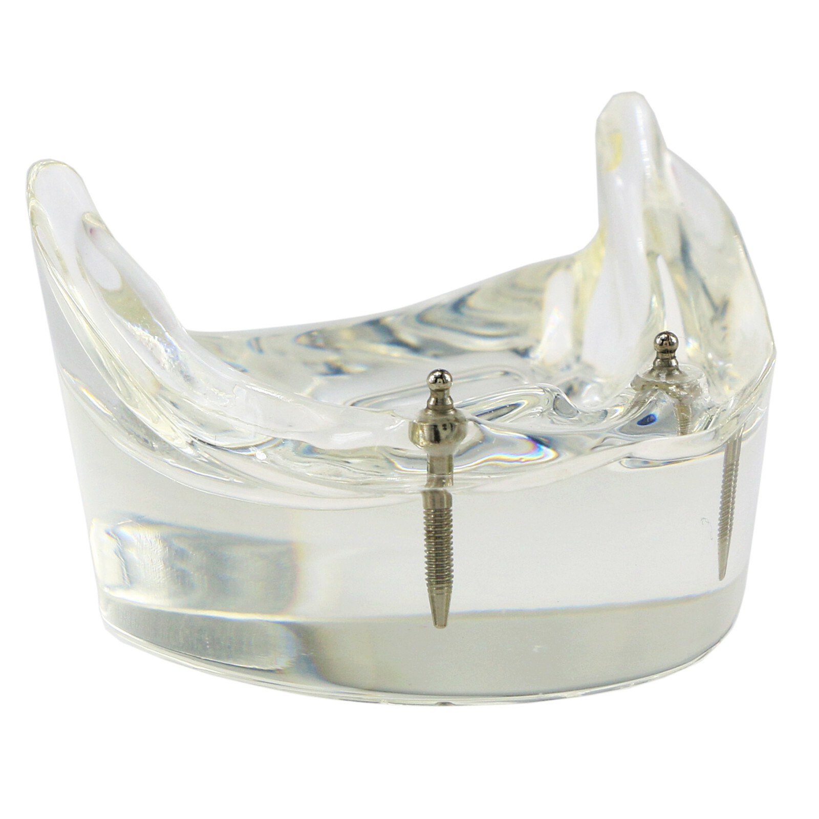 Dental Typodont Teeth Model Overdenture Lower Inferior 2 Implants Demo M-6002 US