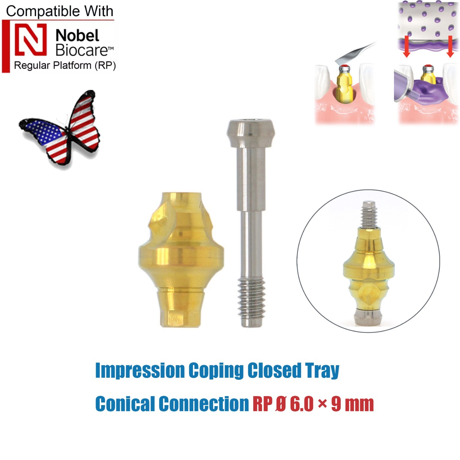 Dentaltech Closed/Open Tray Impression Copings Nobel Biocare Implant Compatible
