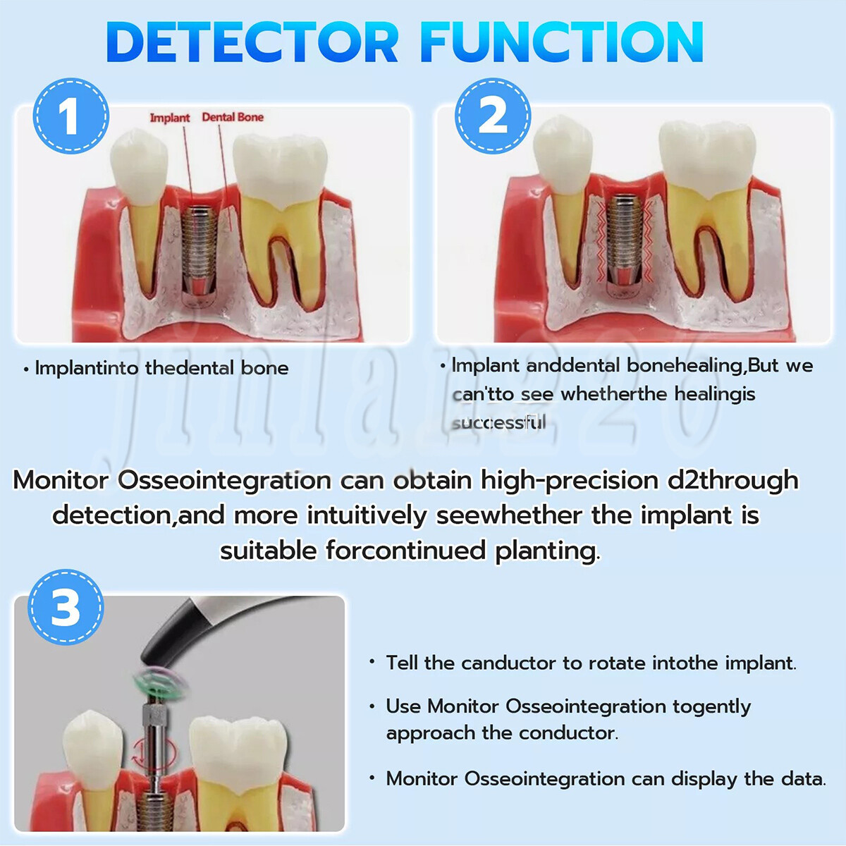 2024 Dental ISQ Implant Stability Device Dental Implant Monitor Osseointegration