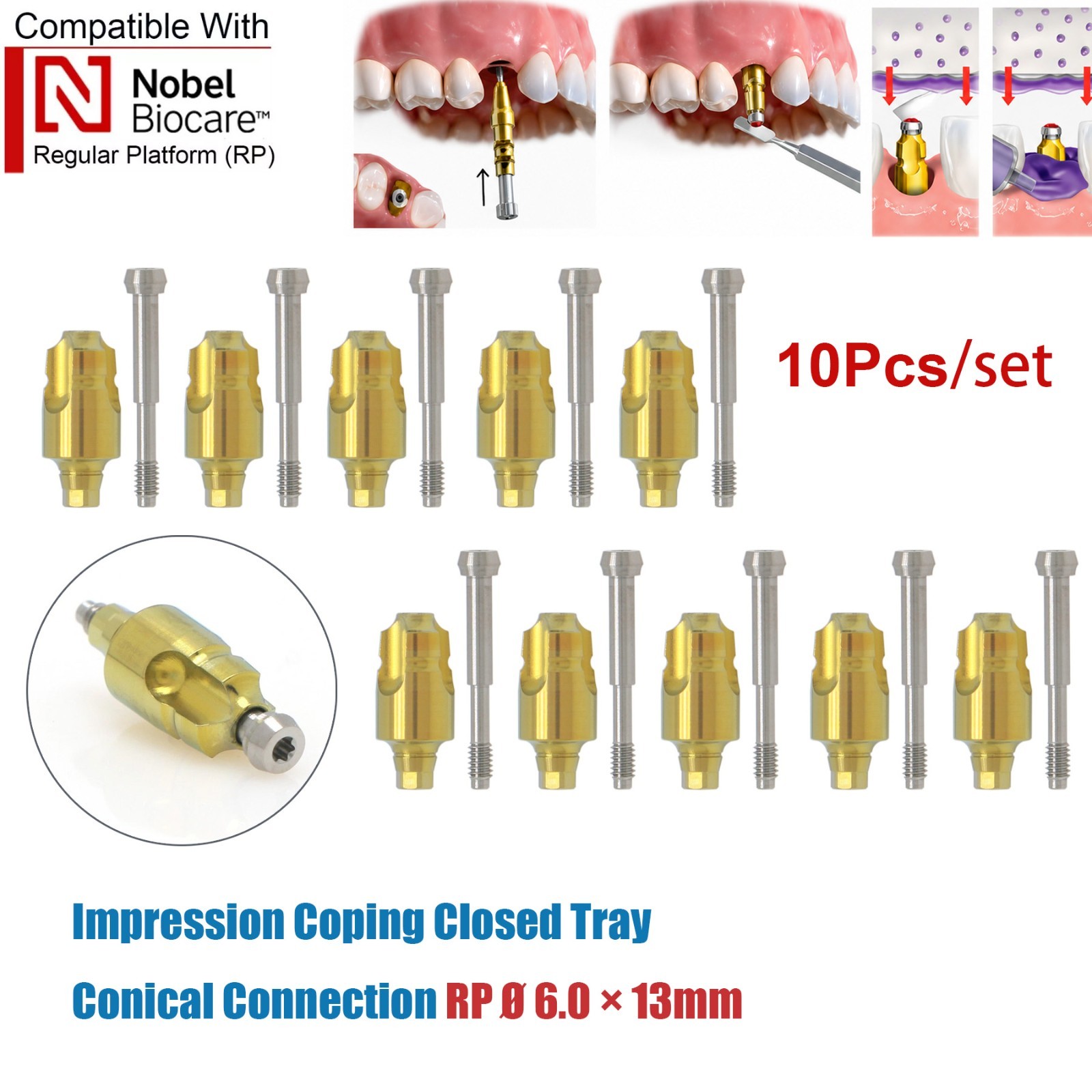US 10Pcs Impression Transfer Coping Open Closed Tray fits Nobel Active NP RP Hex
