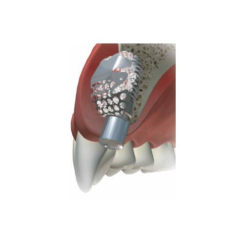 DSI Dental GBR Implant Titanium Surgical Barrier Membrane Mesh Plate 0.1mm