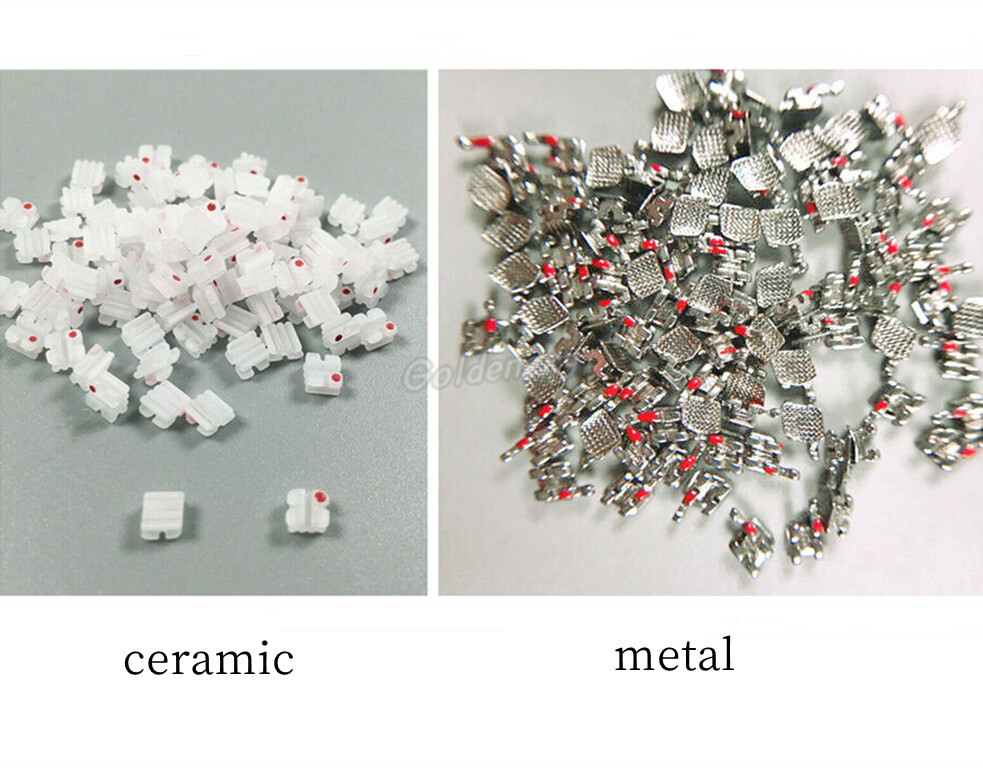 100Pcs Dental Orthodontic Bracket Ceramic Metal In Bulk Mini Roth 022 345 Hooks