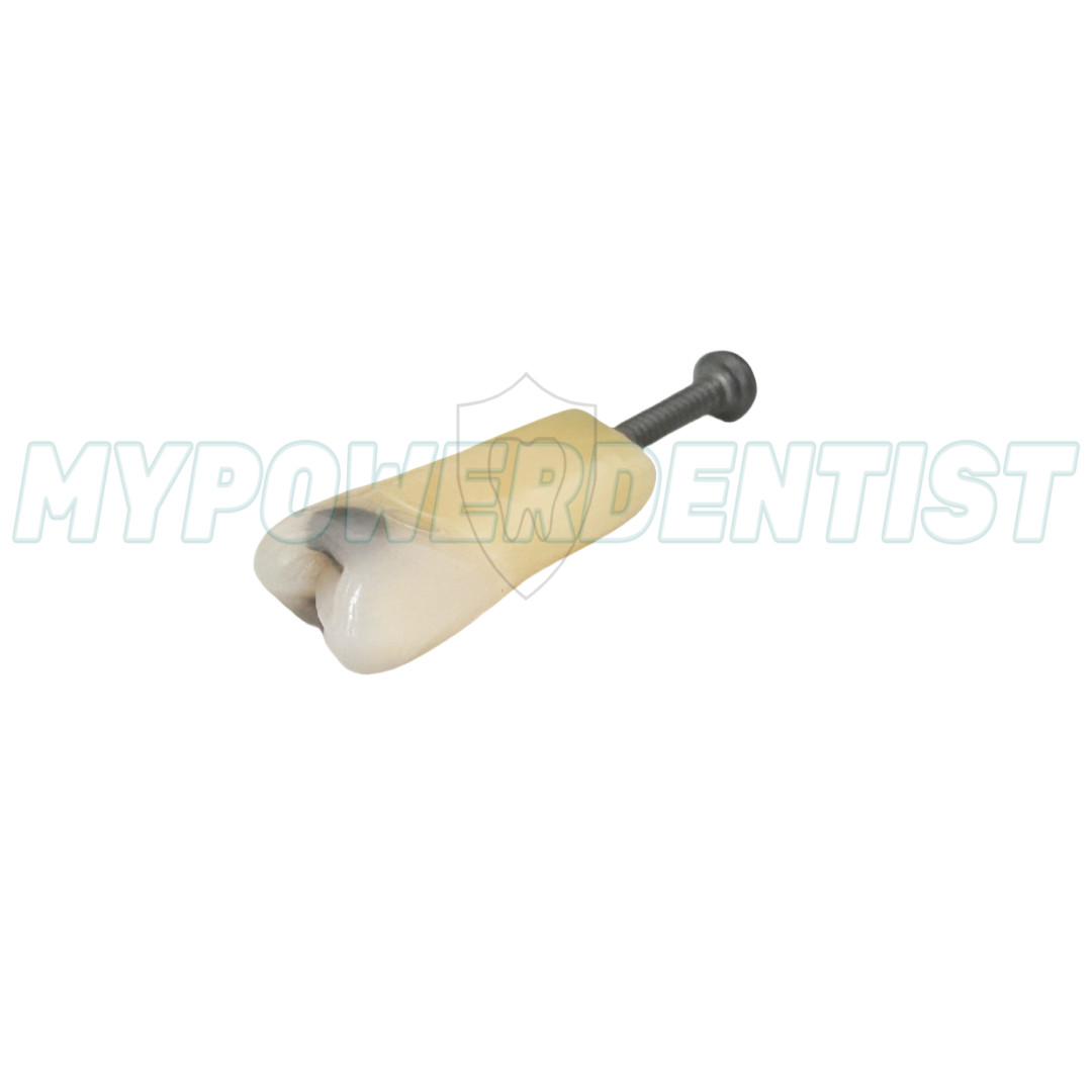 Dental Cavity Teeth Model Tooth Teaching Caries 25# Compatible Frasaco AG-3