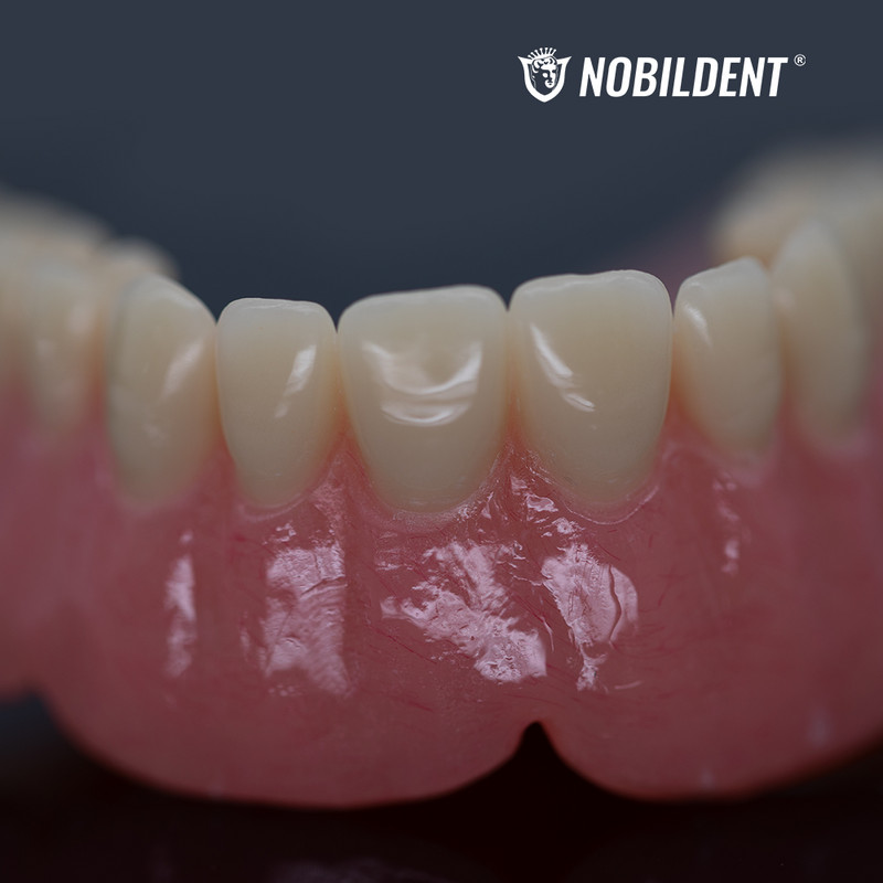 1000g HEAT CURRING Acrylic Resin Powder Denture Base Polymers Resin Powder ONLY