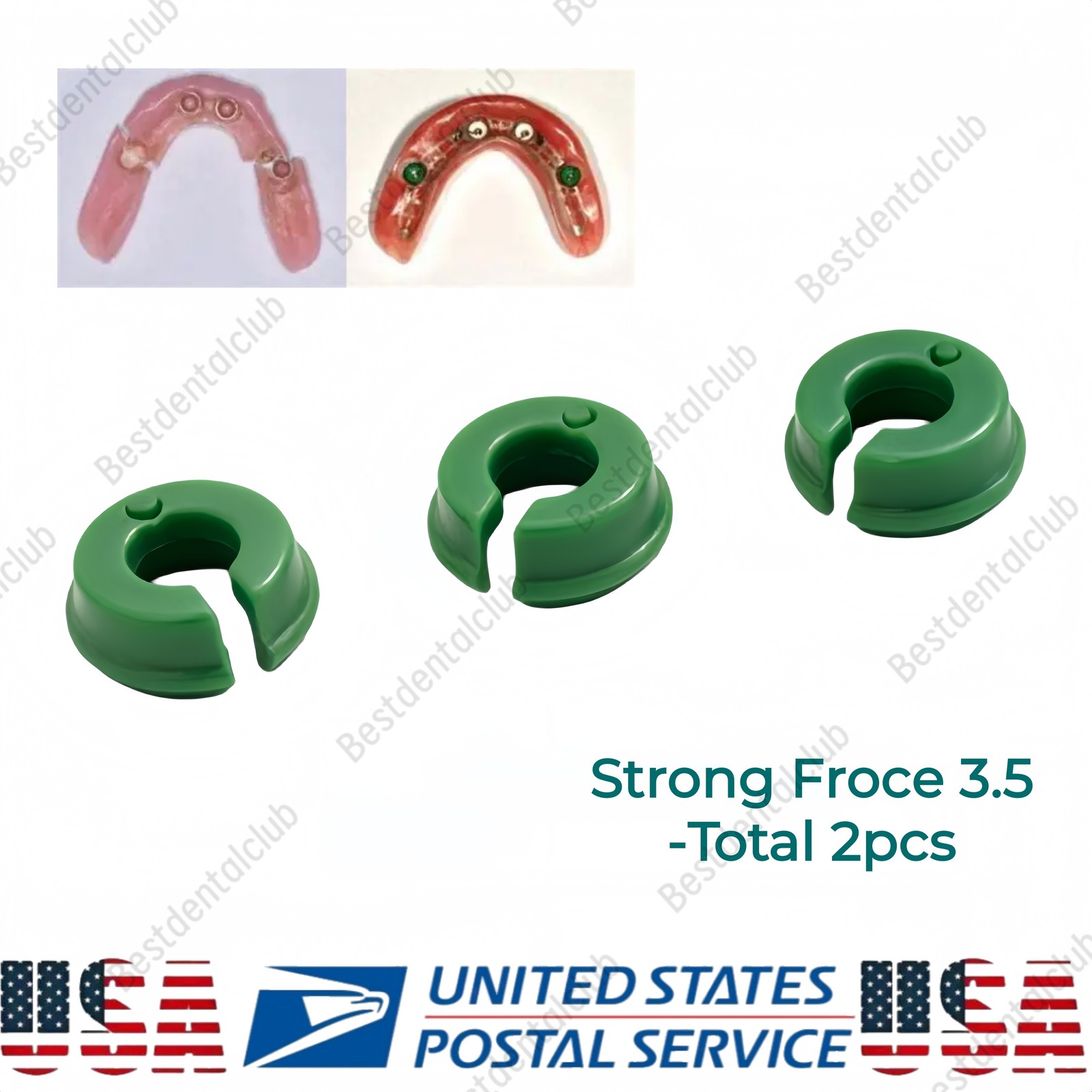 2Pcs Novaloc Type Retention Inserts Caps Dental Peek Matrix Titanium Housing Cap