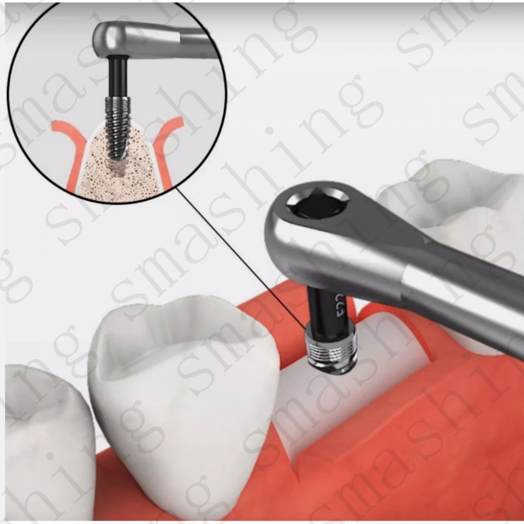 Dental Driver Ratchet Broken Implants Pick Up Extractor Failed Fixture Remove