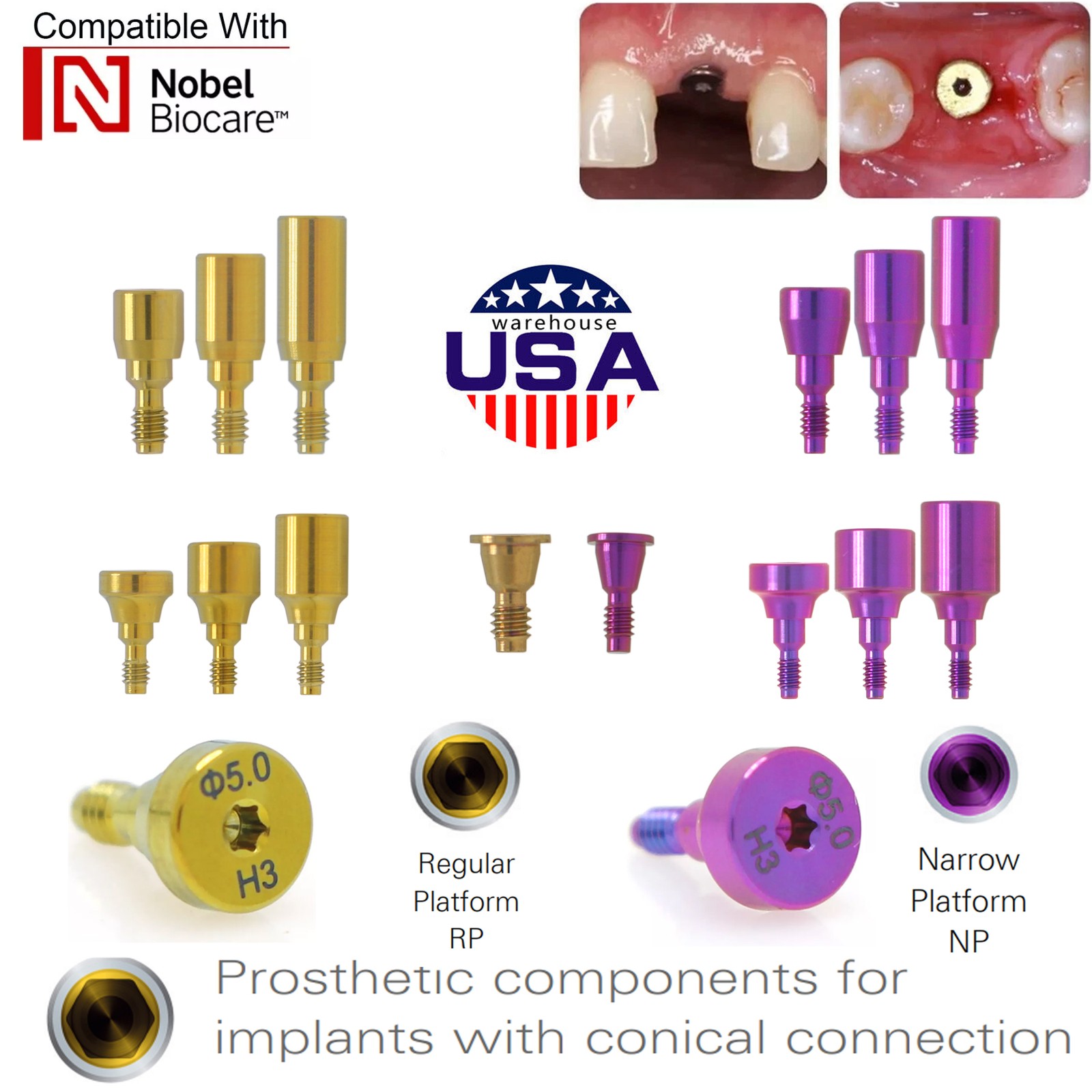 US 5Pc Dental Healing Abutment NP/RP Fit Nobel Biocare Internal Conical Titanium