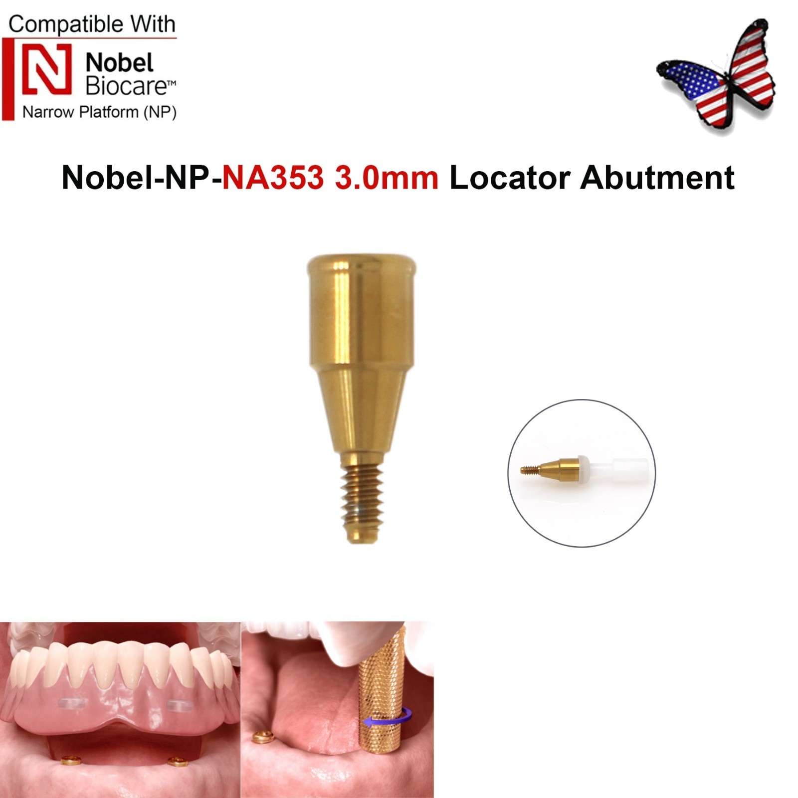 Locator Attachment Tapered Overdenture Abutment Fit Hiossen/Nobel/Biocare/Zimmer