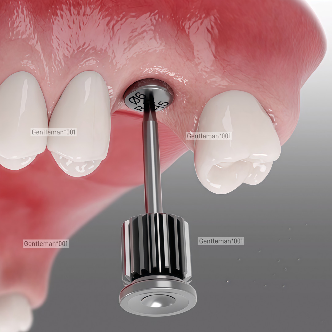 Dental Implan Healing Abutment Caps Cover Screw Mini Regular Platform Titanium