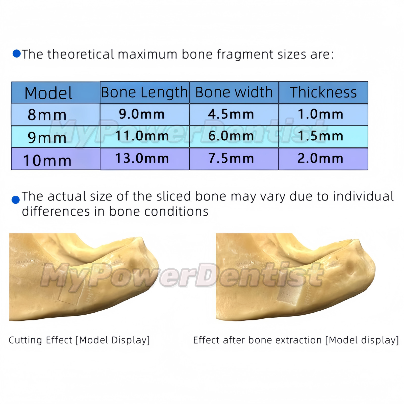 1Set Dental SLT Half Moon Bone Harvest Drill Semilunar Technique Collector Drill