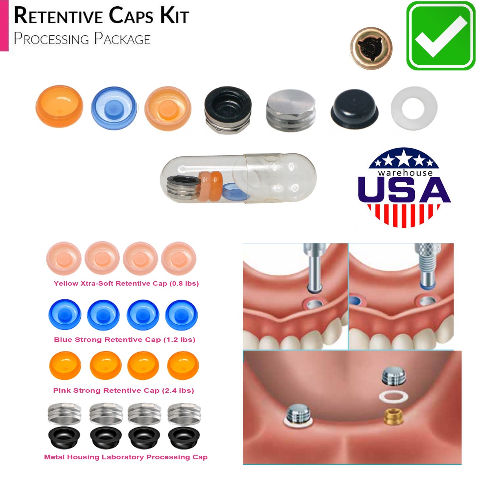 US Dental Locator Abutment Multiple Implant Hiosse/Nobel/Zimmer/BioHorizons/ITI