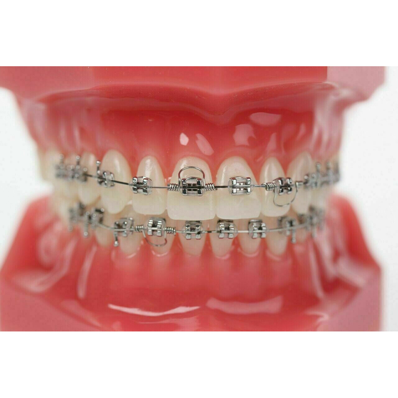 J&J Ortho™ Dental Orthodontic Archway Torquing Arch Spring (10/pk)