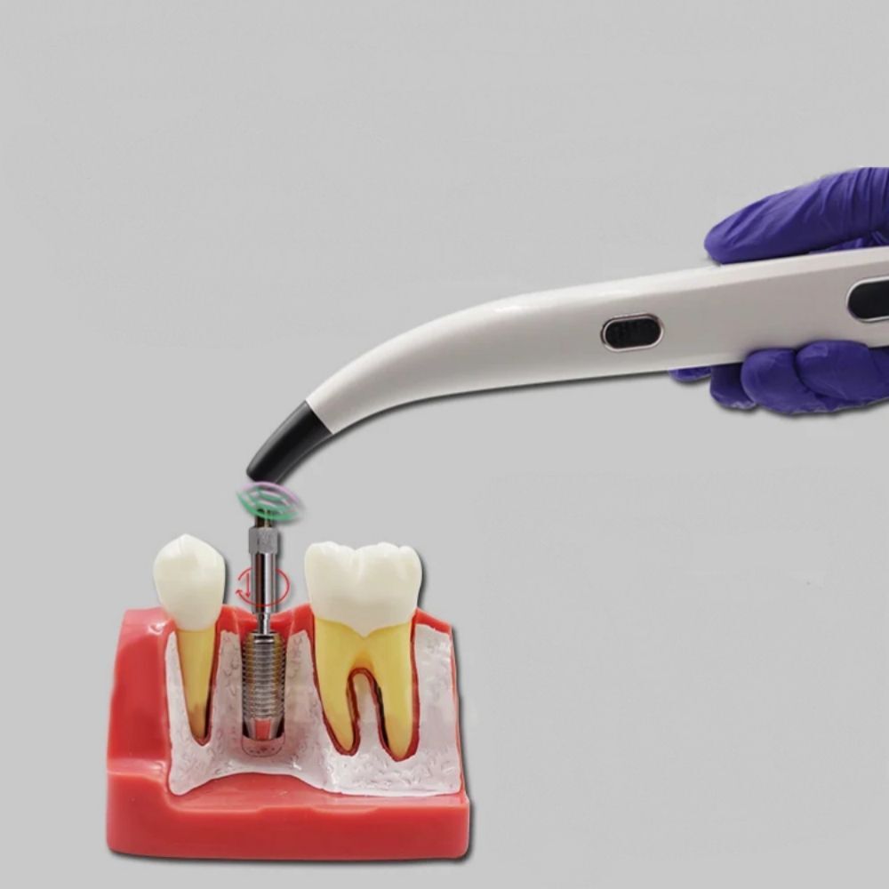 2025 Dental ISQ Implant Stability Device Dental Implant Monitor Osseointegration