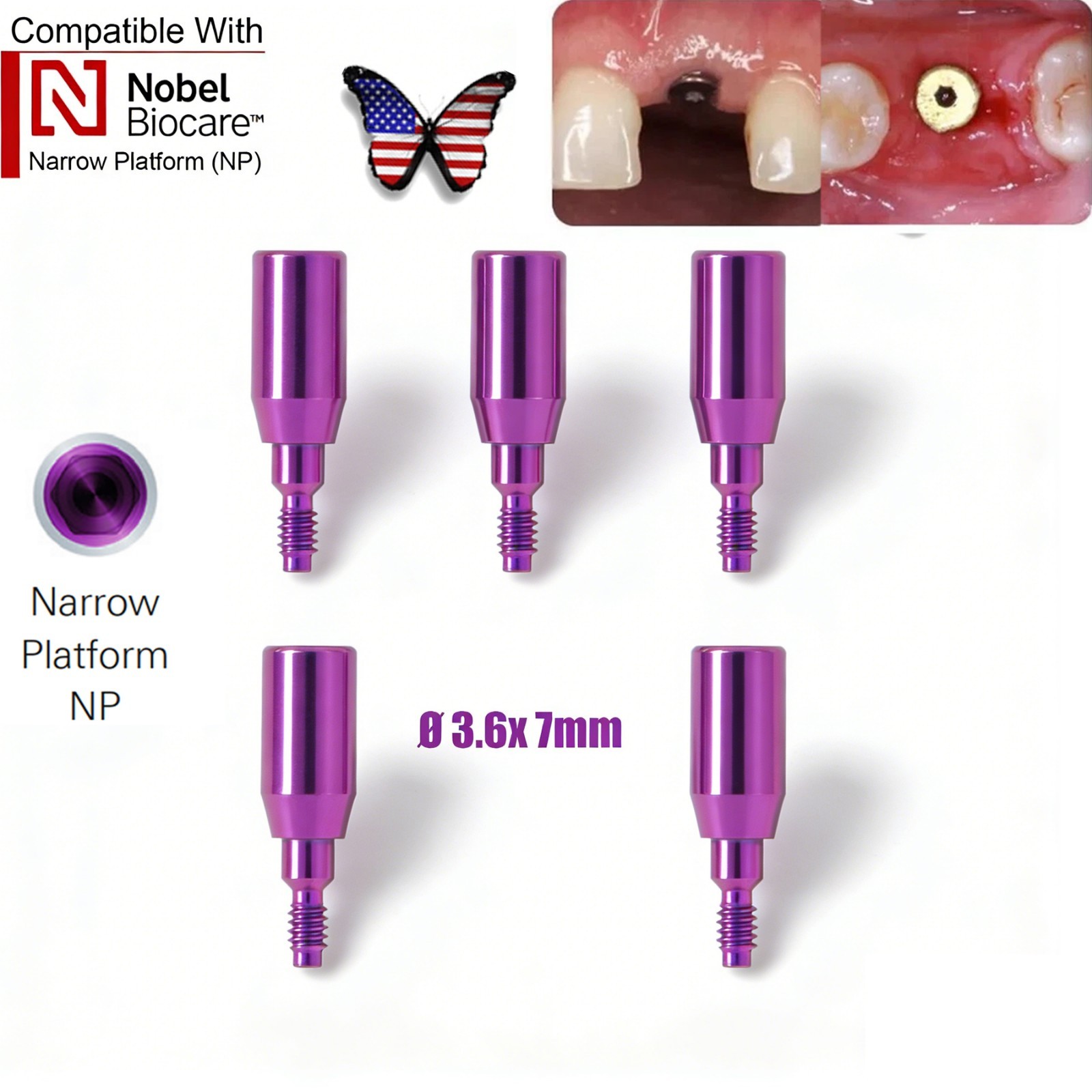 US 5Pc Dental Healing Abutment NP/RP Fit Nobel Biocare Internal Conical Titanium