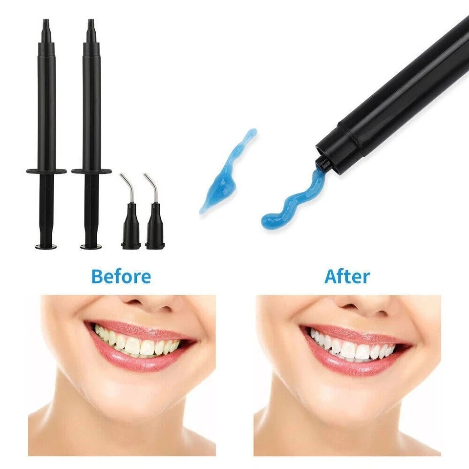 Dental Composite Teeth Whitening Gel Gingival Dam Barrier Gum Protector 1.5/3ml