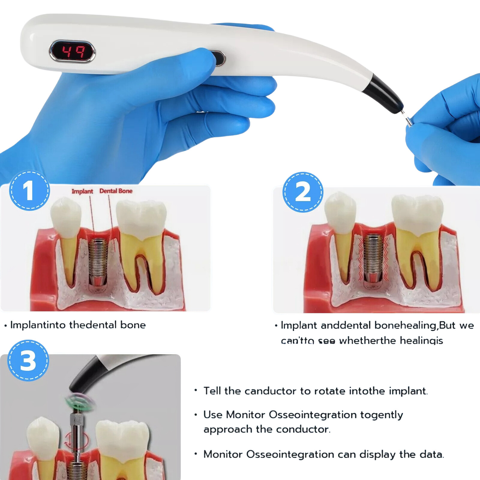 DENTAL NEW Fit OSSTELL BEACON ISQ IMPLANT STABILITY METER FAST SHIPPING