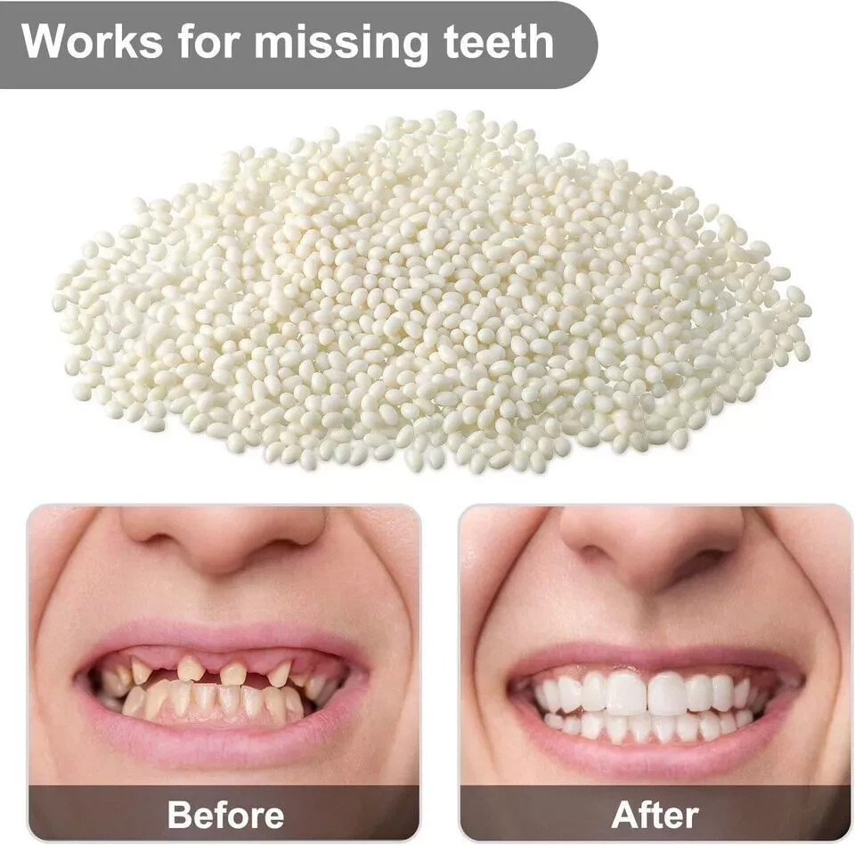 Dental Moldable Thermal Temporary Filling Tooth Material False Repair Replacemen