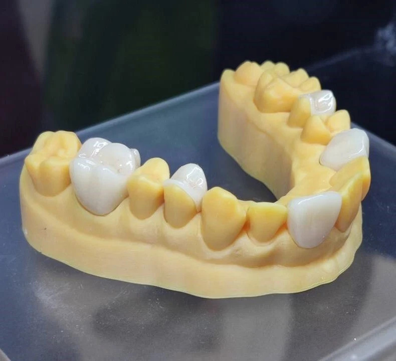 C14 Dental Emax Ceramic Blocks Lithium Disilicate CAD/CAM CEREC Block 5pcs A1 A3