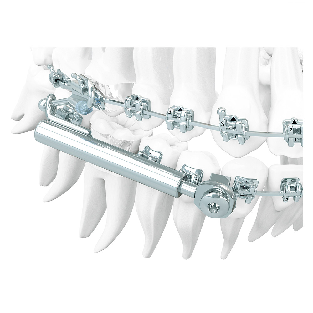 Dentaurum Dental SUS³ Sabbagh Universal Spring Orthodontic Application Set