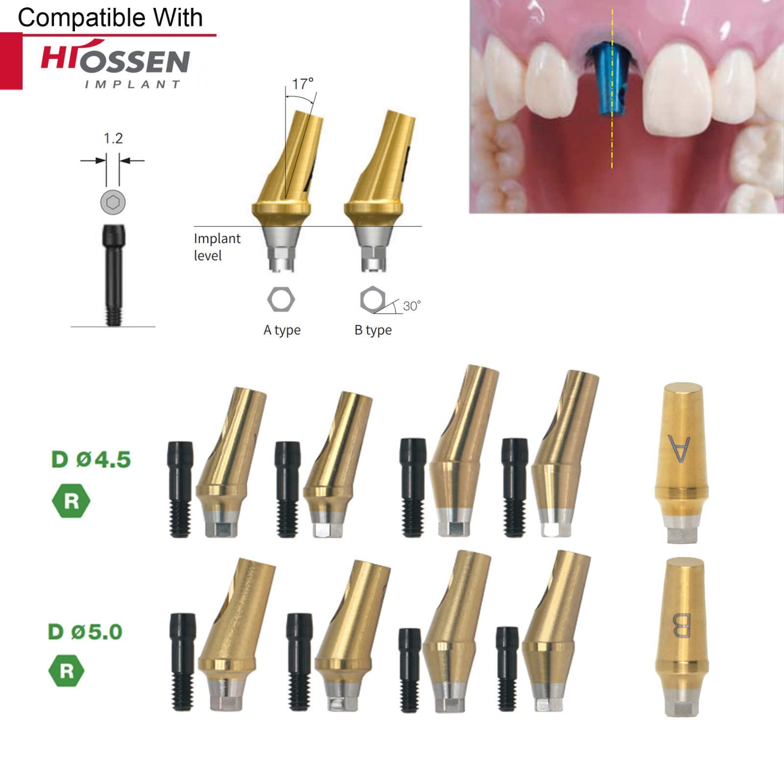 Implant Sinus Lift Temporary/Straight Transfer/Angled Abutments Fits Hiossen Oss