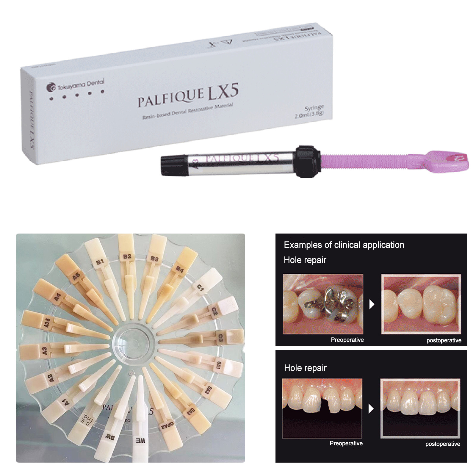Tokuyama Palfique LX5 Resin Based Dental Composite 3.8gm Syr (Free Ship)
