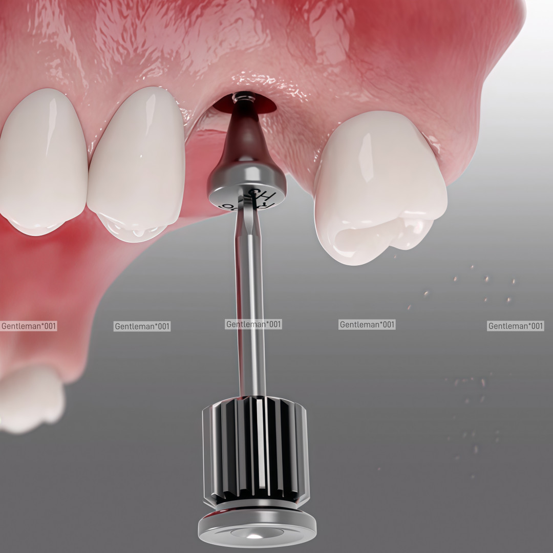 Dental Healing Abutment/Lab Analog Mini Regular Platform Cap Fits Osstem Hiossen