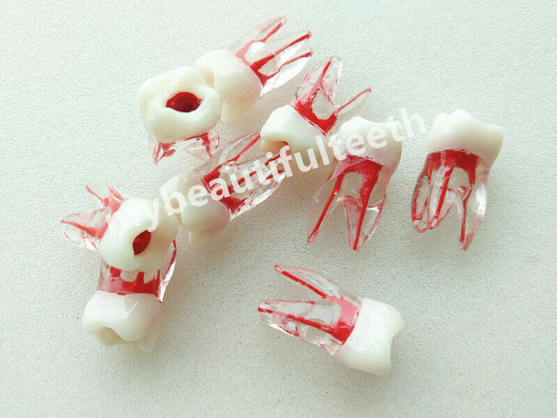 Dental Molar Endo Master Root Canal Study Model RCT Practice Block Pulp Cavity