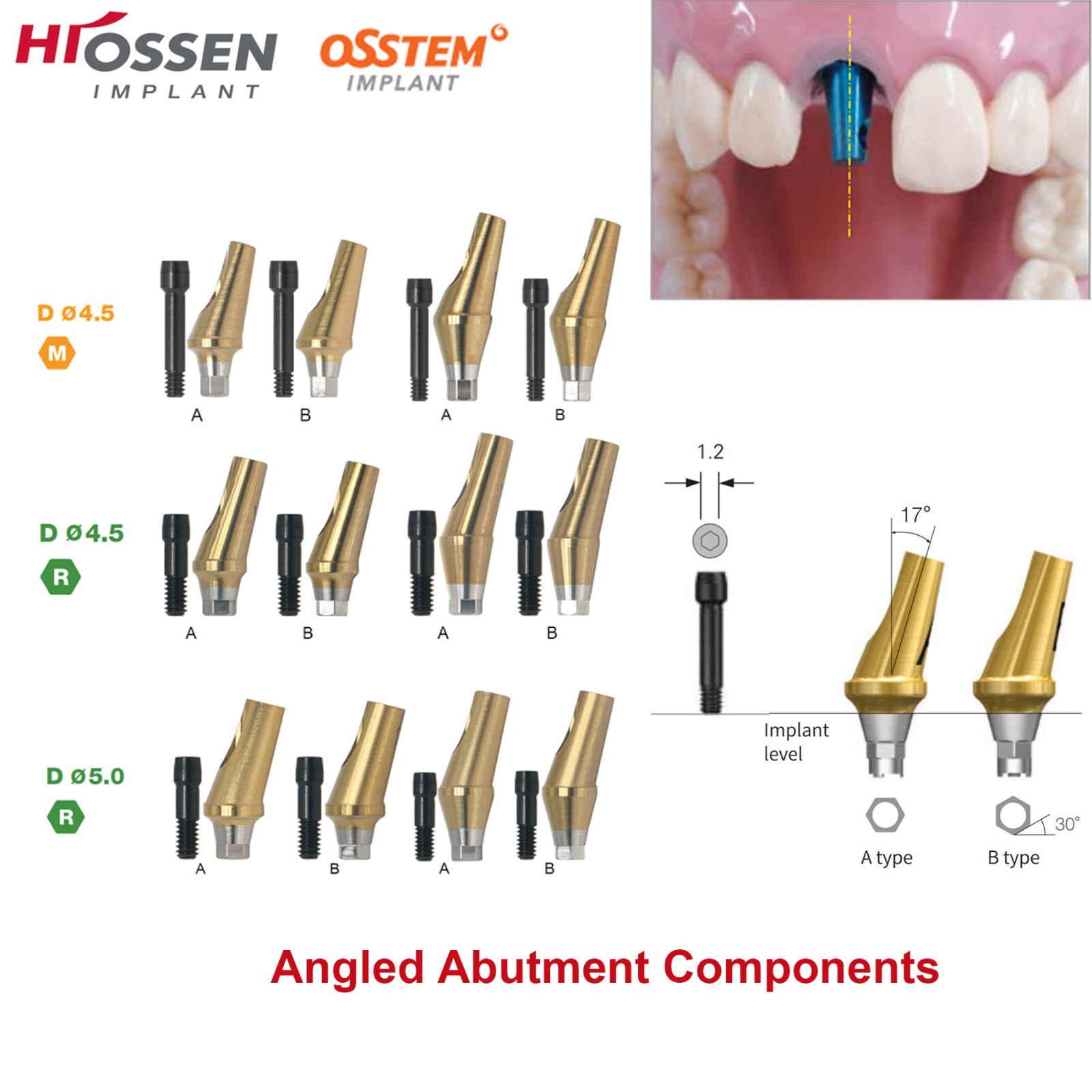 Implant Sinus Lift Temporary/Straight Transfer/Angled Abutments Fits Hiossen Oss