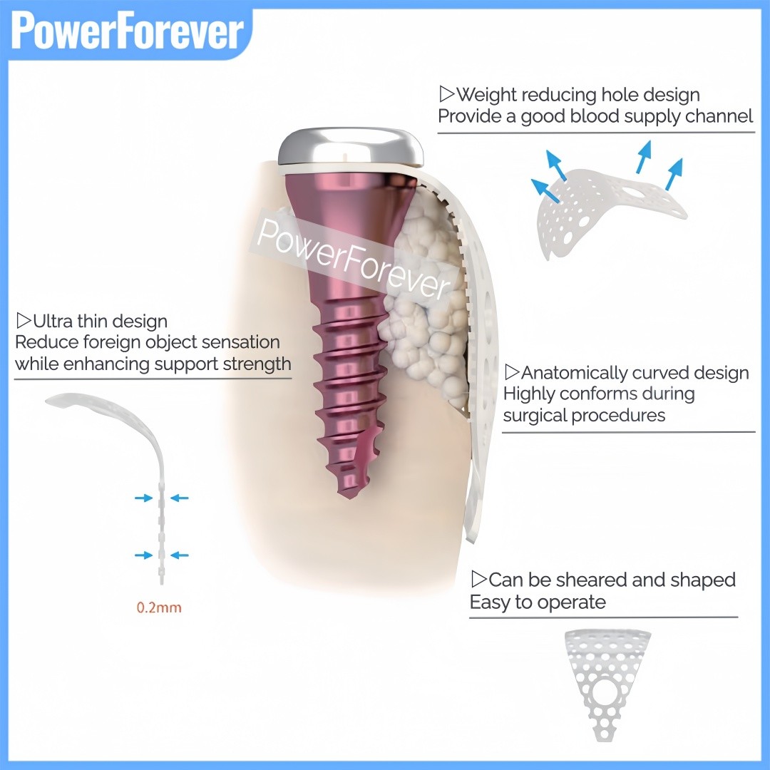 Dental GBR 3D Titanium Mesh Bone Incremental Membrane Implant Bone Formation