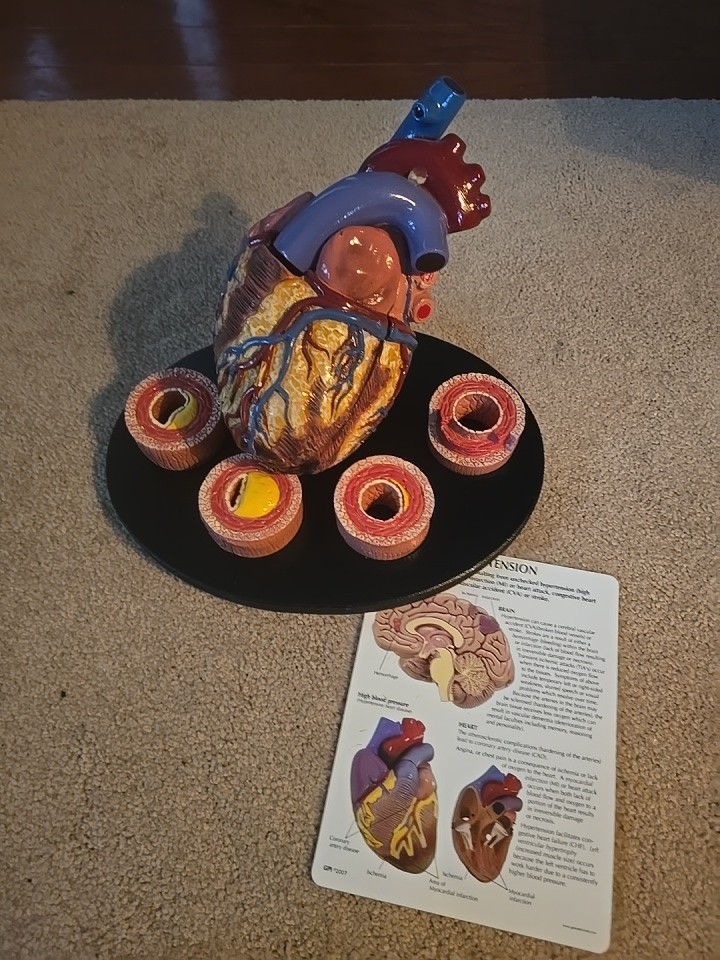 GPI Anatomical Heart Model, 2 Part – GP2500 With Card And Tray