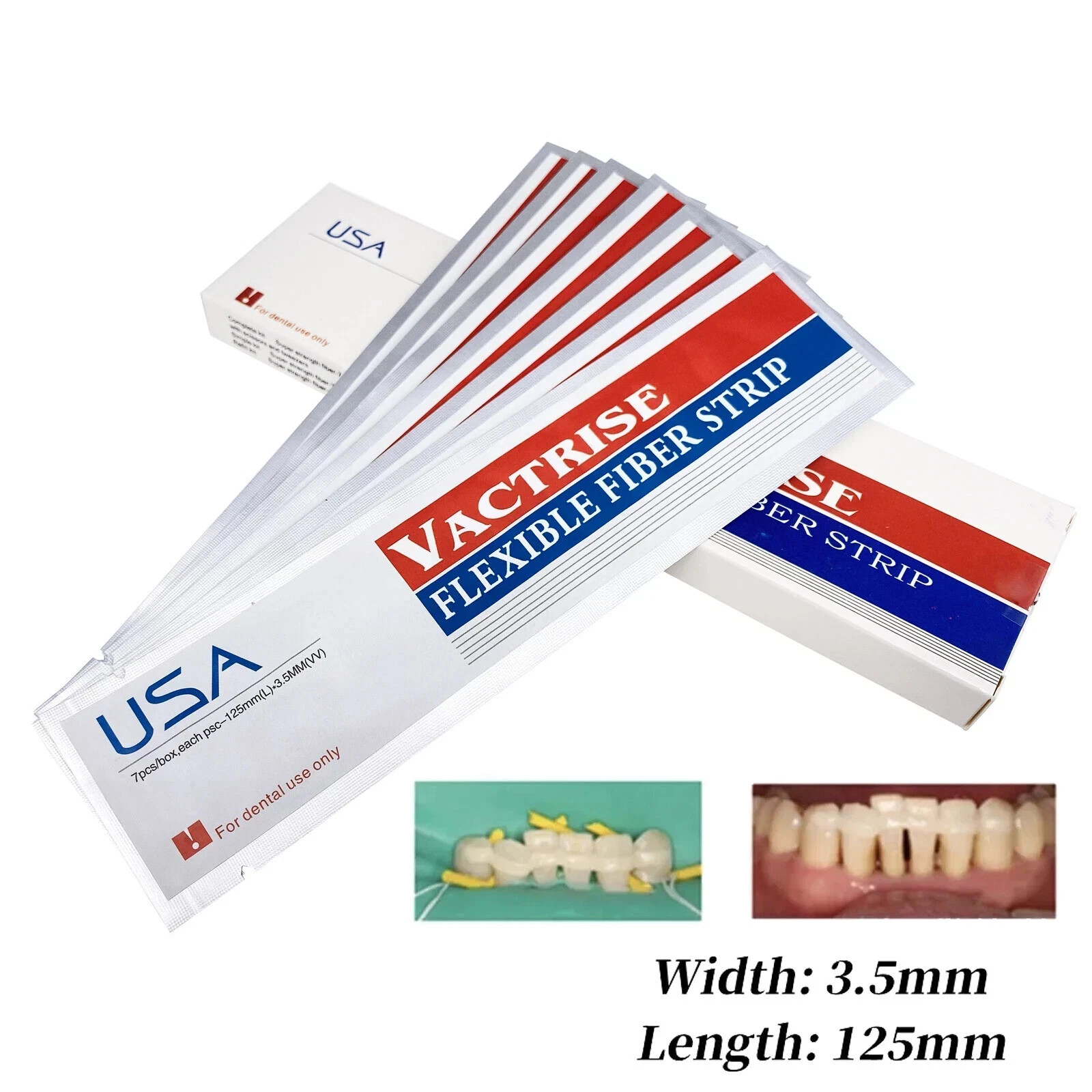 5 Box Dental Light Cure Flexible Glass Fiber Splint Composite Bonding Strip Tool