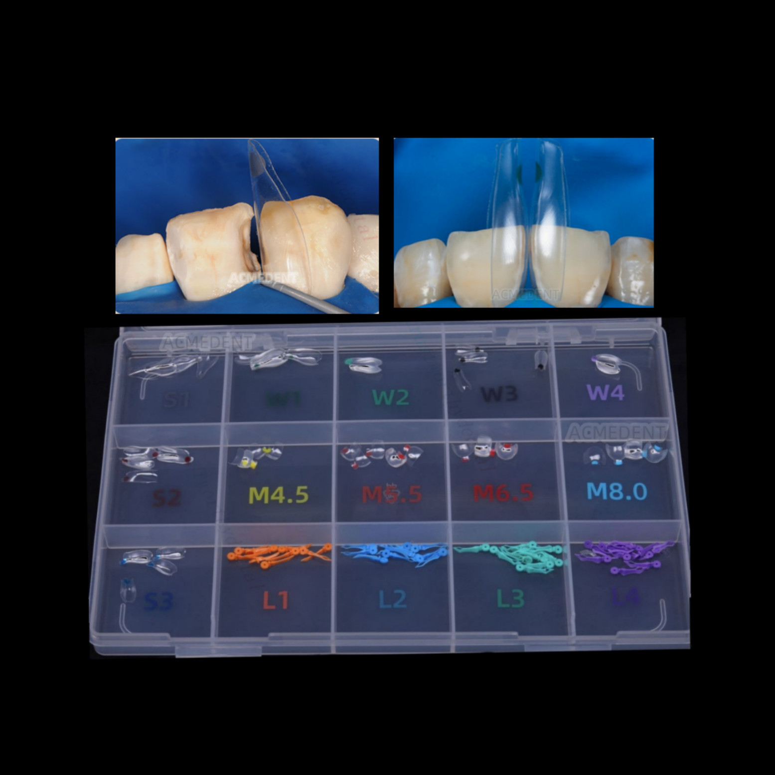 Clear Matrix Dental Anterior Matrices Posterior Class II Fit BioClear Fit Biofit