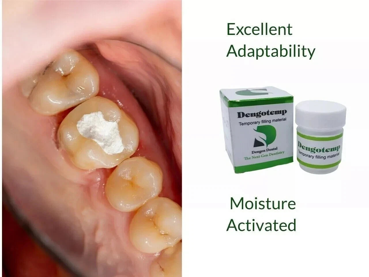 Dental DENGOTEMP Temporary Filling Material Paste 40g Jar