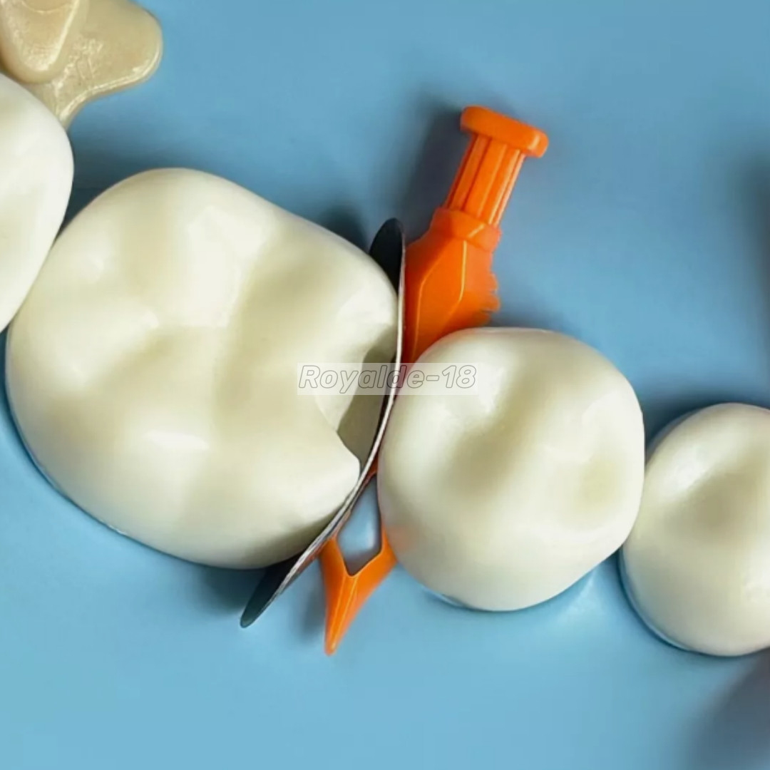 80PCS Dental Diamond Wedges Collapse Expand Plastic Tooth Gap Sectional Matrix