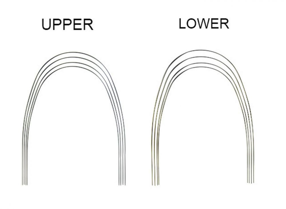 Phyx Preformed SS Archwire Round (Pk of 10)