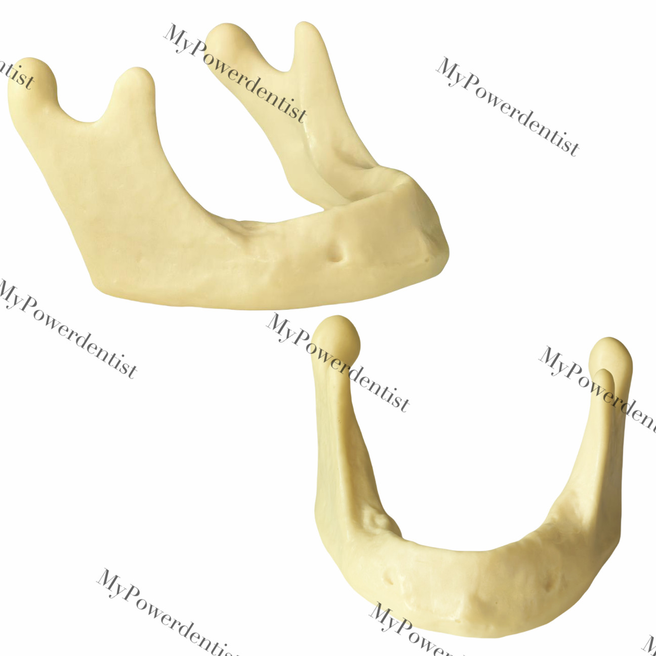 Dental Resin Alveolar Jaw Bone Replica Study Model Embed GBR Practice Blocks