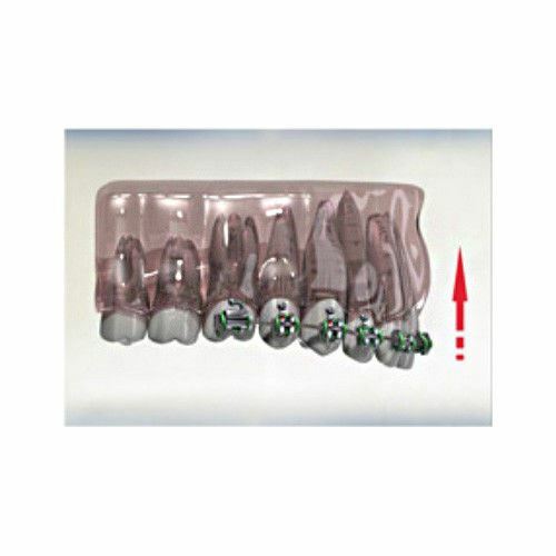 Morelli NiTi Dental Orthodontic Reverse Curve Spee Archwire Round 10 Wires
