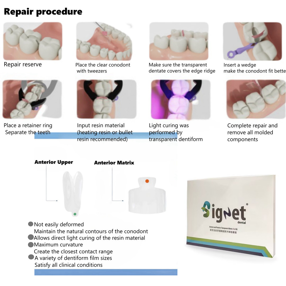Dental Signet Anterior and Posterior Transparent Matrix Triall Molding Kit