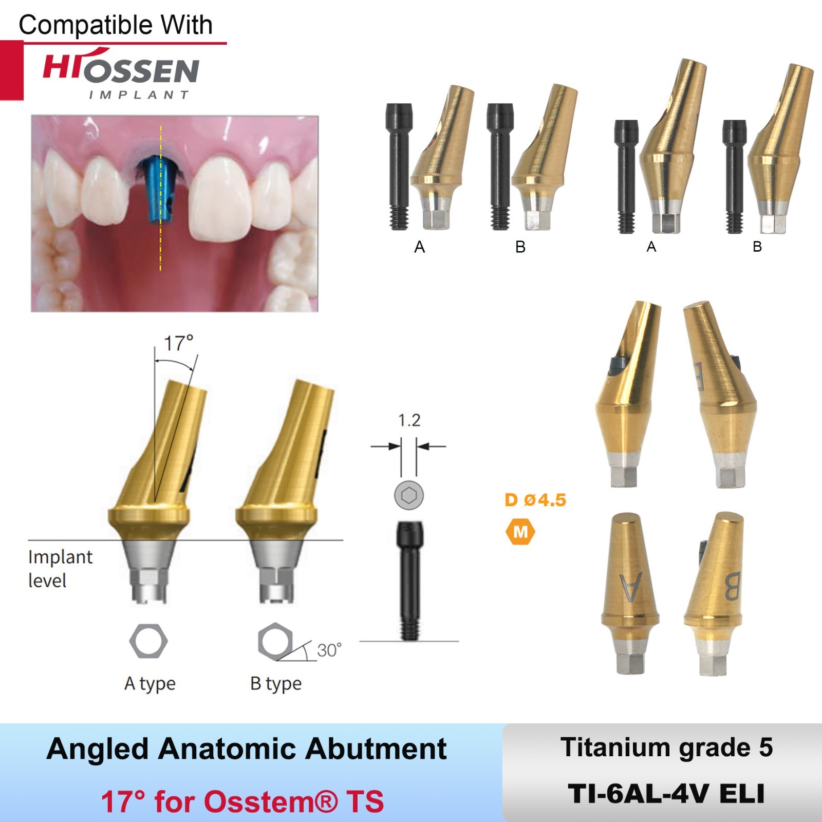 Implant Sinus Lift Temporary/Straight Transfer/Angled Abutments Fits Hiossen Oss